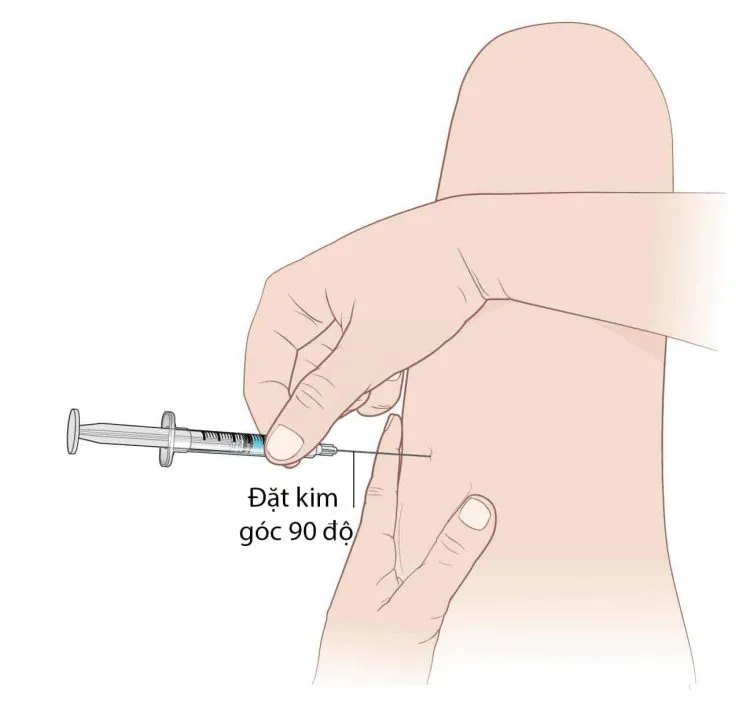 Cách kiểm tra vị trí tiêm bắp