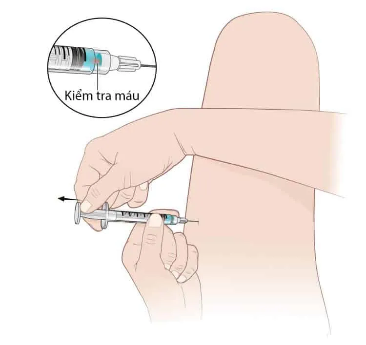 Kiểm tra vị trí tiêm bắp