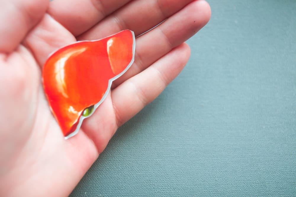 Viêm gan C có thể làm nước tiểu sẫm màu