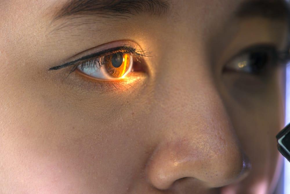 Chẩn đoán co đồng tử