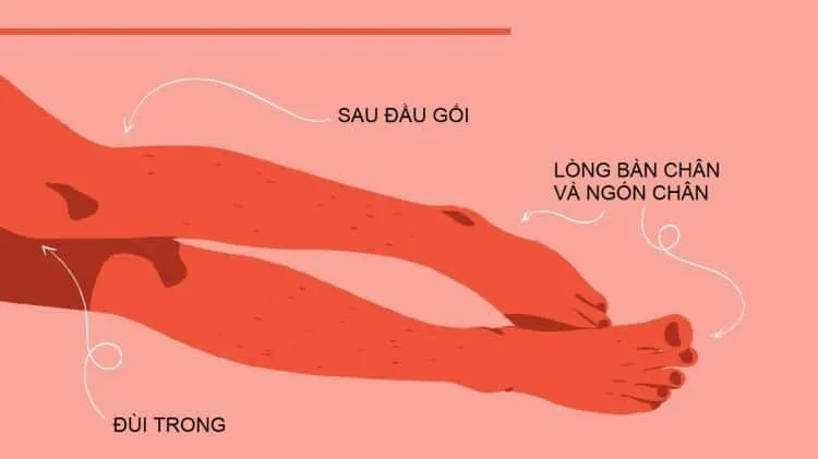 Điểm kích thích phổ biến: Đùi trong