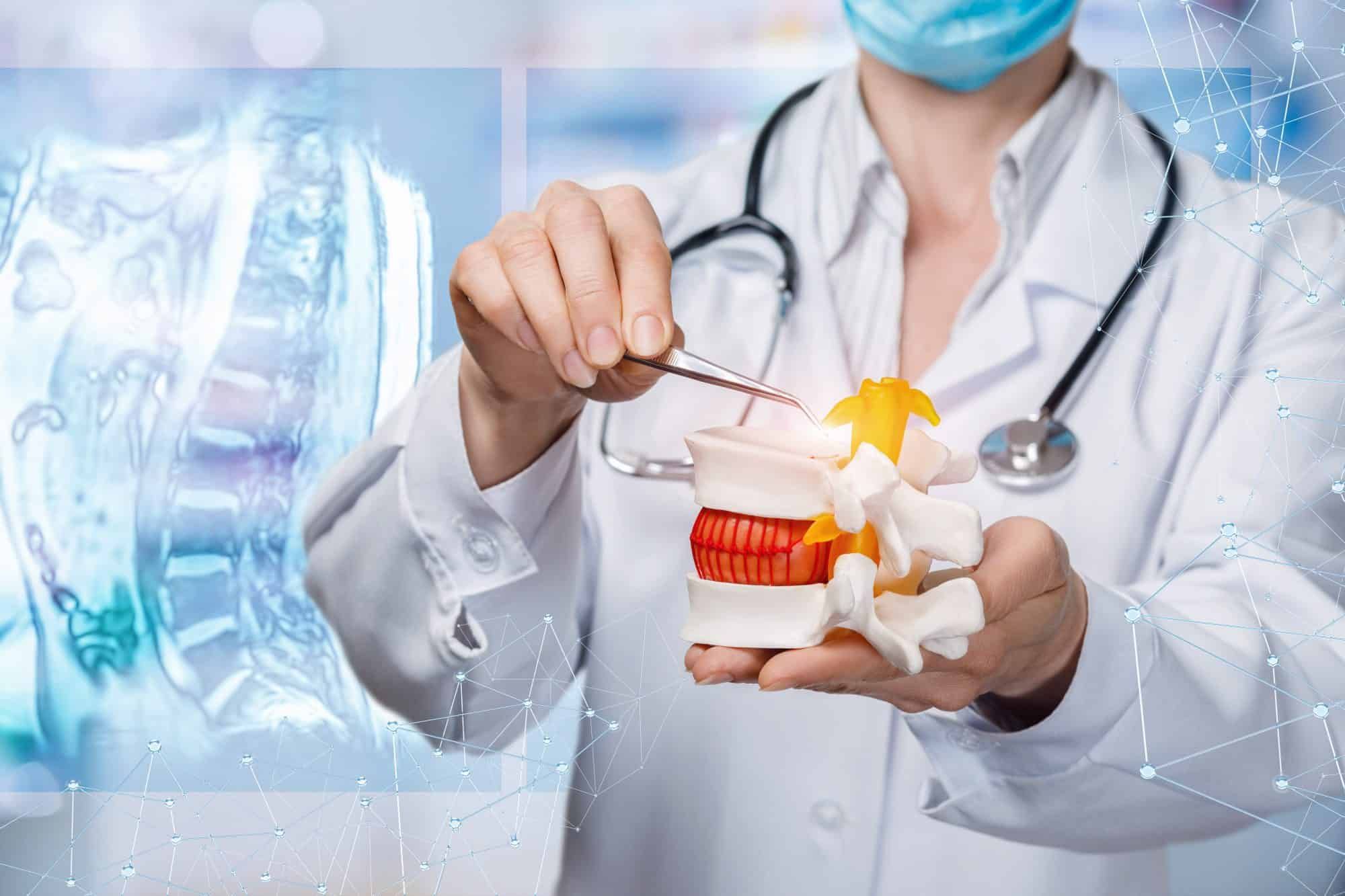 Điều trị thoát vị đĩa đệm