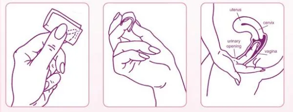 Cách sử dụng màng phim tránh thai VCF