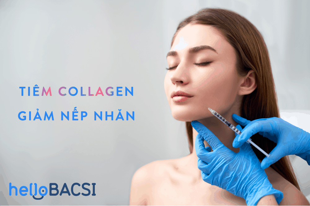 Tiêm collagen làm giảm nếp nhăn