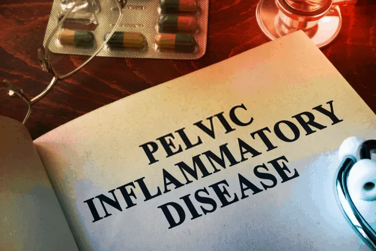 Khí hư màu nâu báo hiệu bệnh viêm vùng chậụ