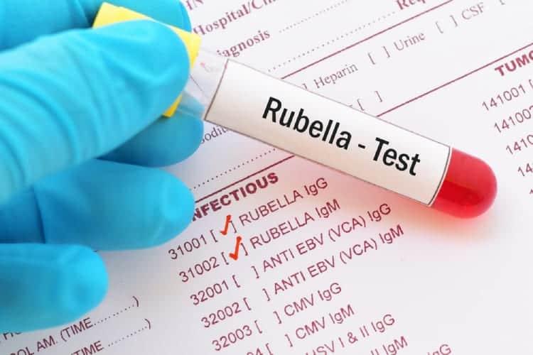 Xét nghiệm kiểm tra rubella khi mang thai