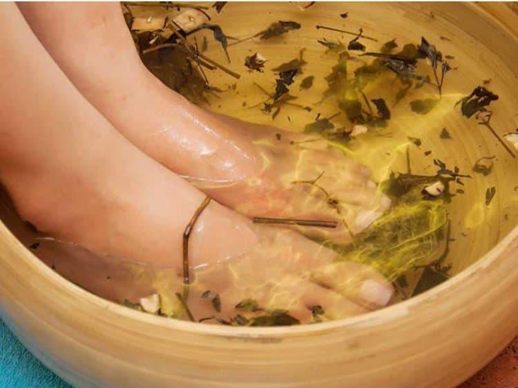 bị nứt gót chân