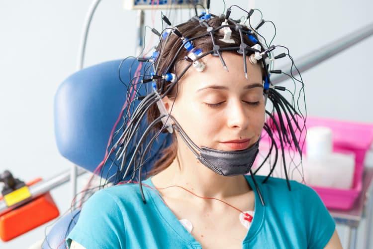 Điện não đồ là gì?