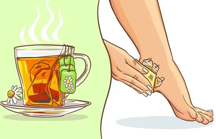 Những cách để vết thương mau lành