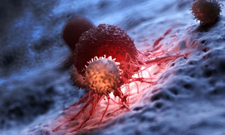 ung thư chưa rõ nguyên phát