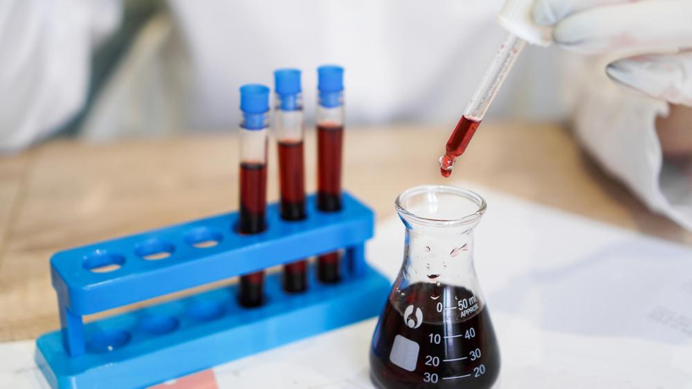 chẩn đoán và điều trị tăng tế bào lympho