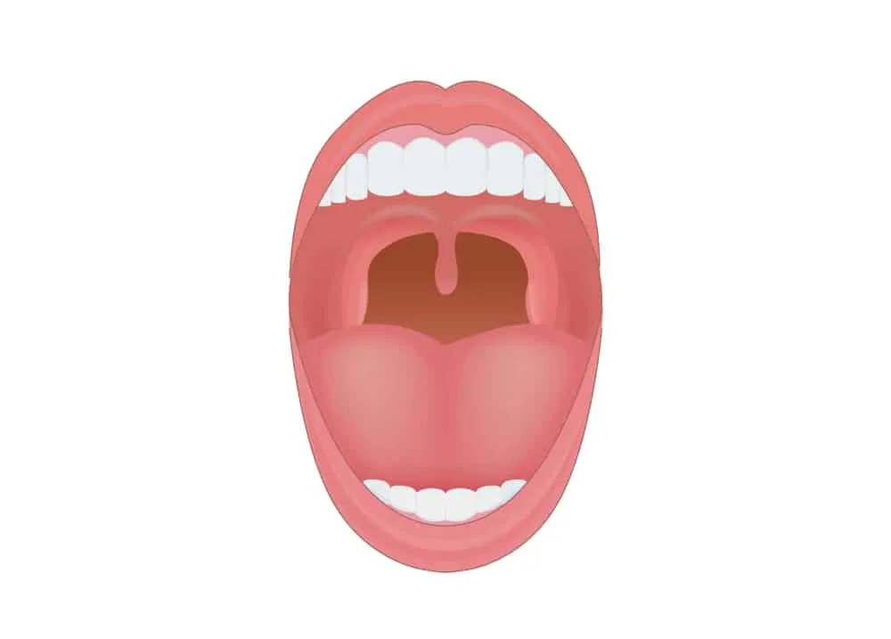 Viêm lưỡi gà là gì