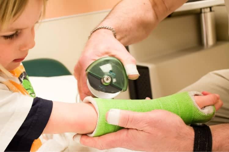 Kết quả bó bột