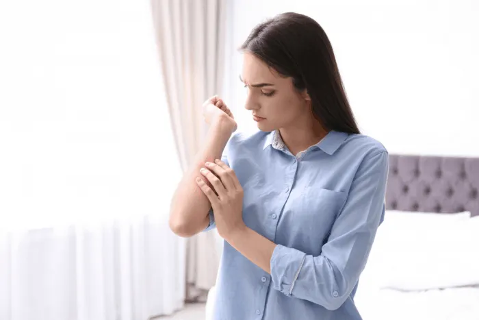 bệnh lupus gây các bệnh về da