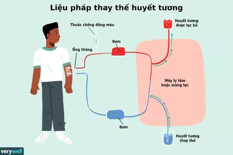 quá trình thay thế huyết tương