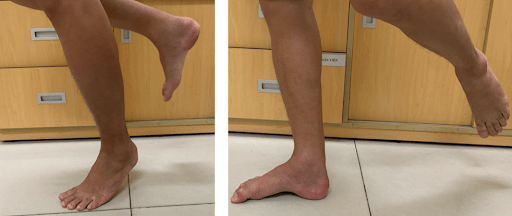 không thể nhón gót chân