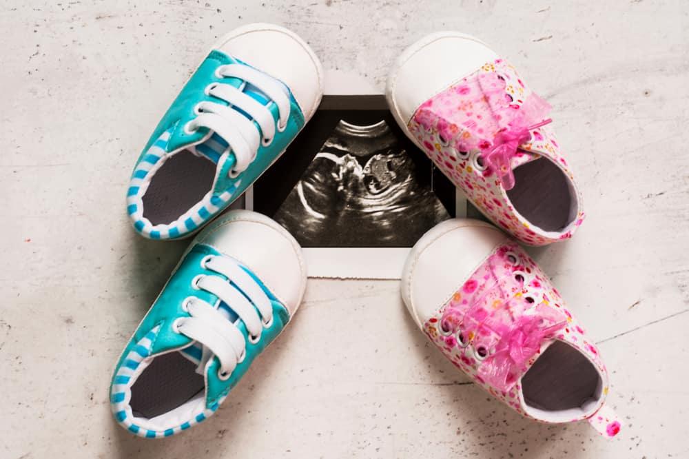 siêu âm thai 34 tuần