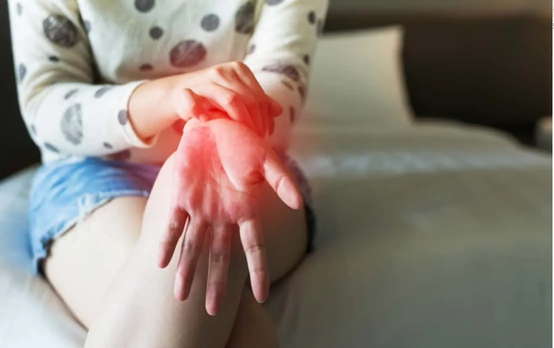 ngứa lòng bàn tay do viêm da tiếp xúc