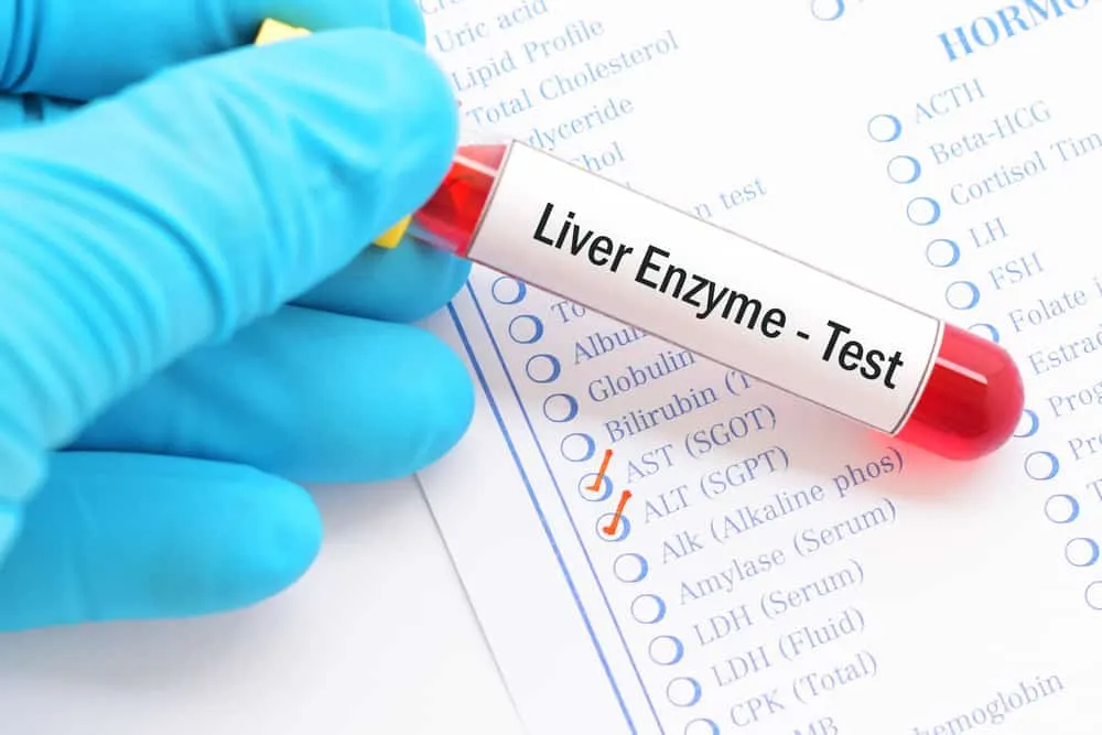 Xét nghiệm chỉ số men gan