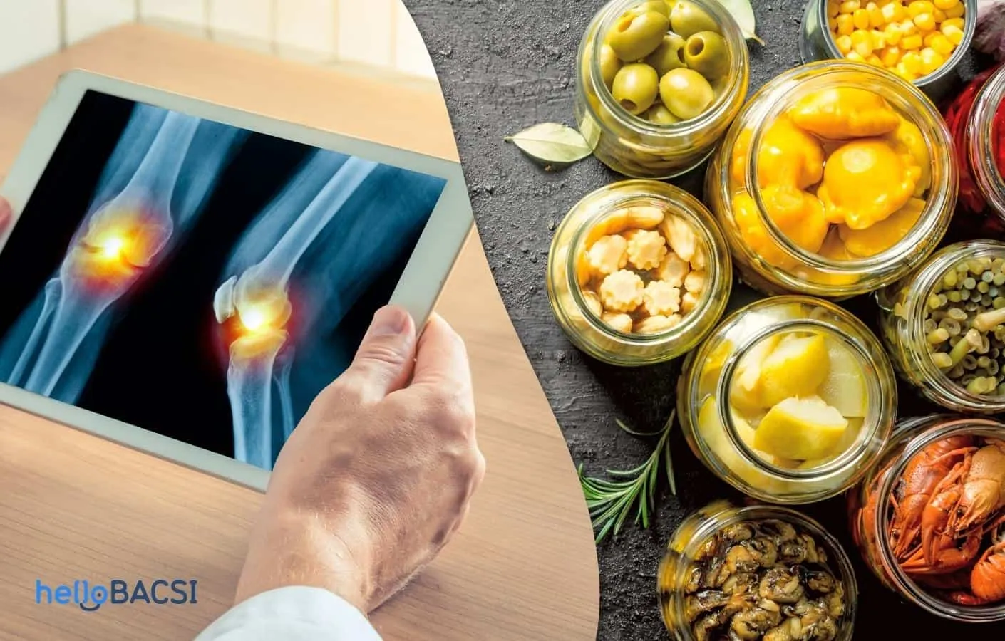 ăn đồ chua có tốt không