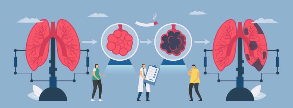 tắc nghẽn phổi tắc nghẽn mạn tính sống được bao lâu