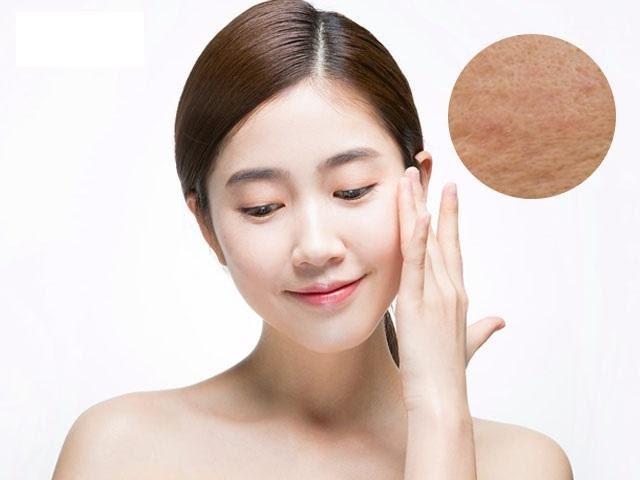 Chăm sóc da sau phương pháp Laser CO2 Fractional