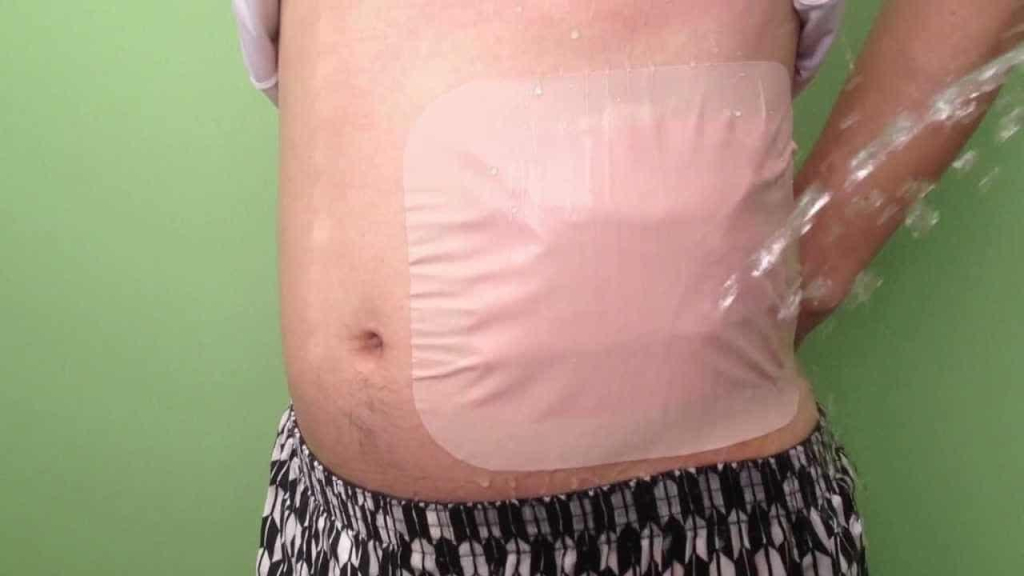 phụ kiện cho túi hậu môn nhân tạo