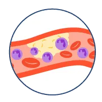 Rối loạn tiểu cầu