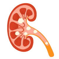 Sỏi đường tiết niệu