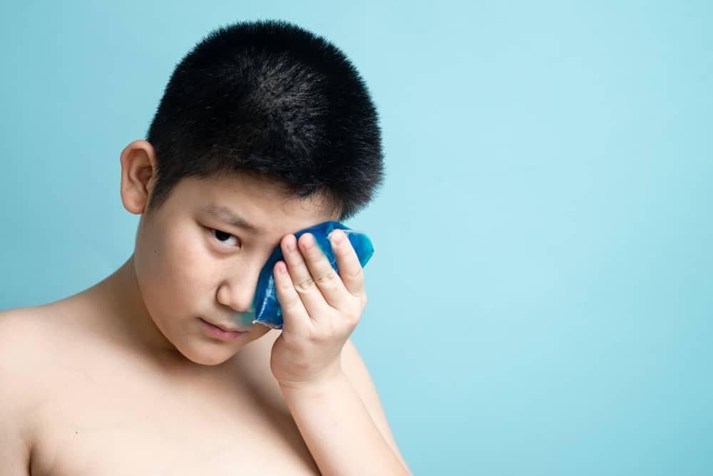 cách chữa chắp mắt