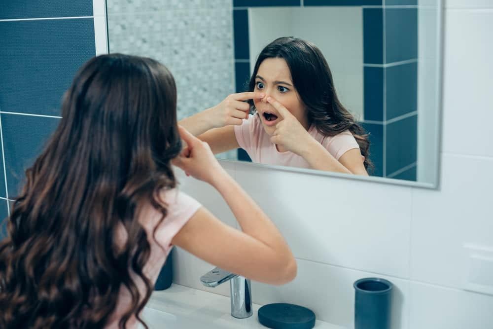 mụn ở tuổi dậy thì