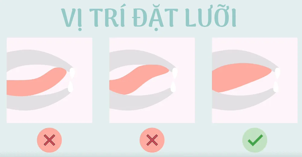 Cách thực hiện phương pháp mewing