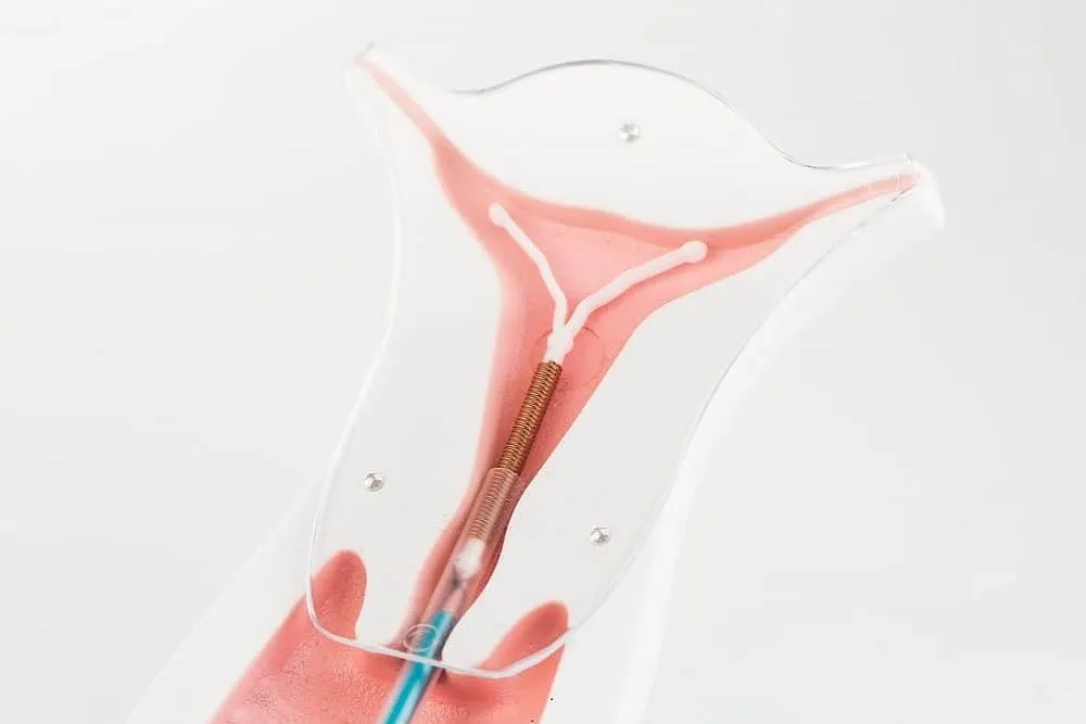 tháo vòng tránh thai bao lâu thì quan hệ được