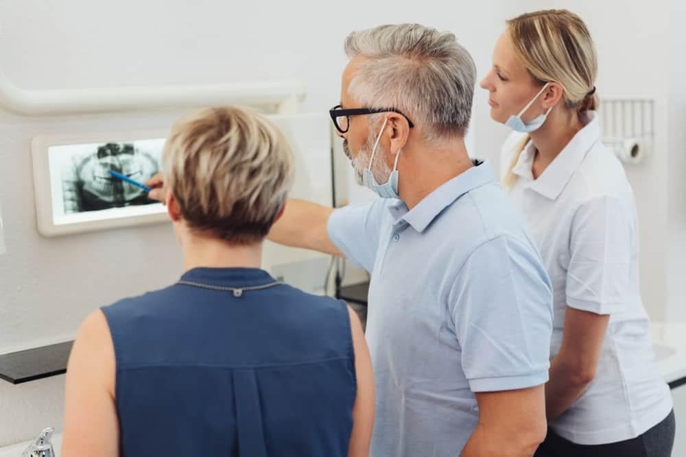 tiêu xương ổ răng 2