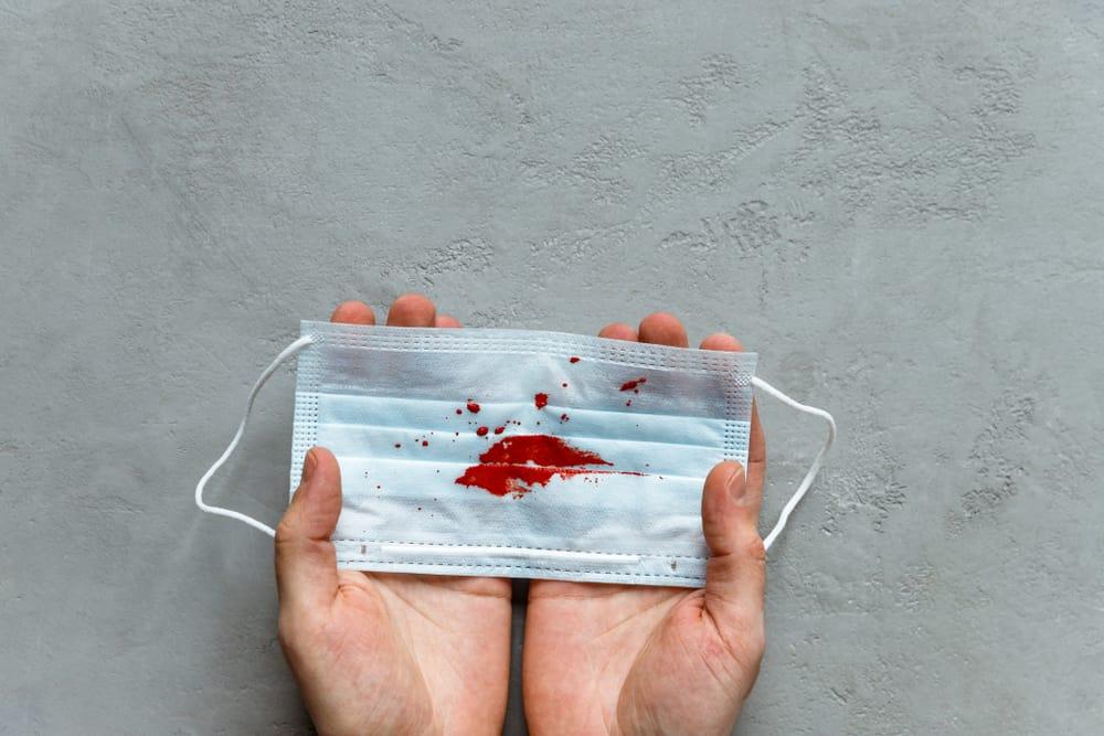 Giãn phế quản có nguy hiểm không? Ho ra máu là biến chứng giãn phế quản