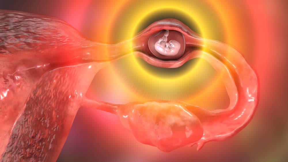 Thai ngoài tử cung