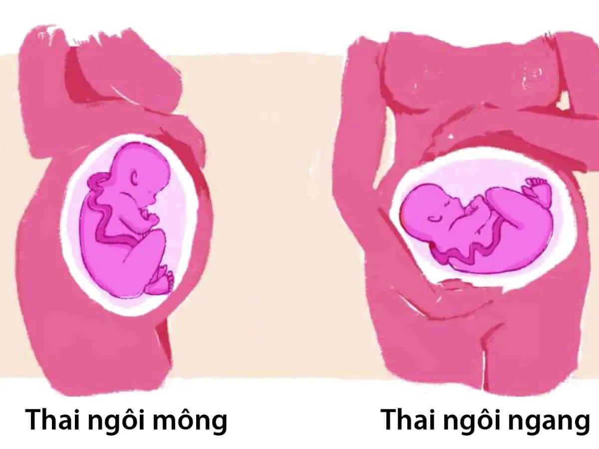 thai ngôi ngang