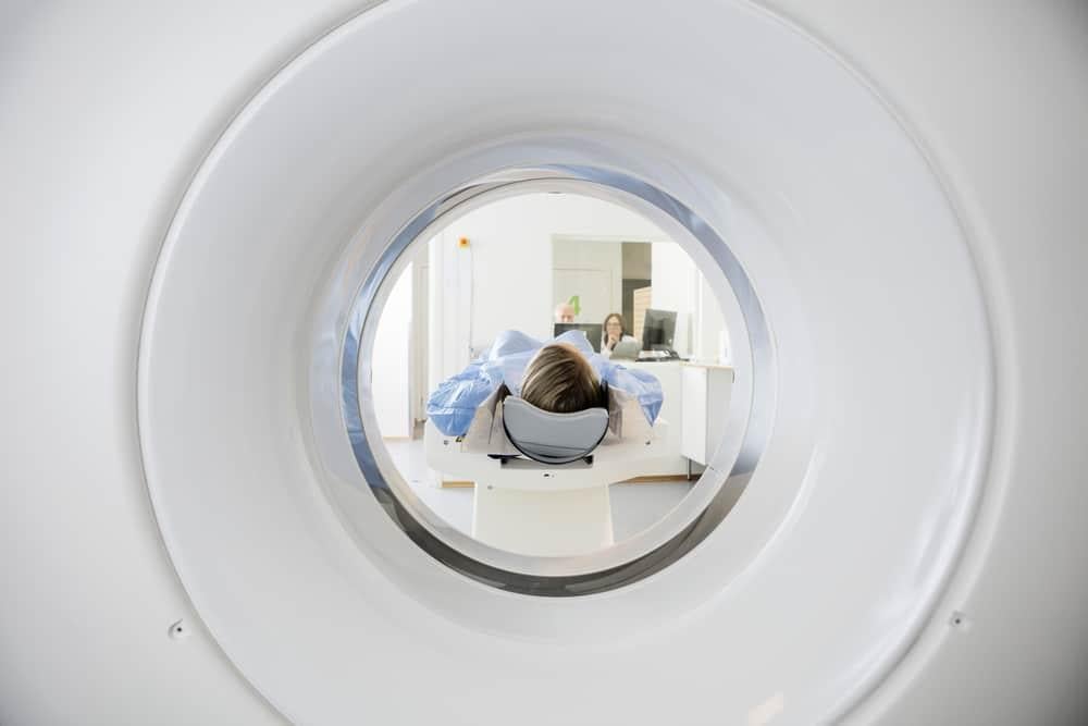 CT scan trong chẩn đoán teo cơ delta