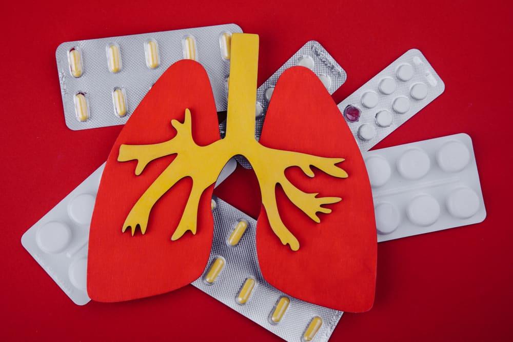 nguyên nhân bệnh lao phổi và cách phòng ngừa