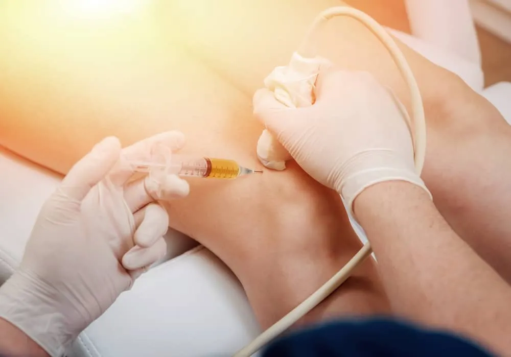 Tiêm huyết tương giàu tiểu cầu