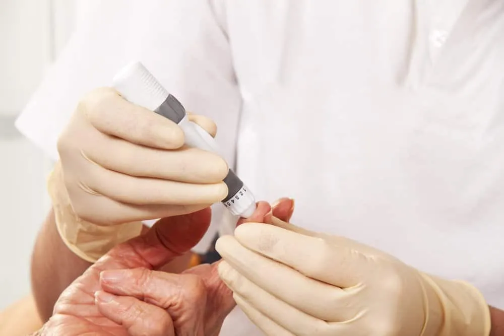 xét nghiệm chỉ số HbA1c