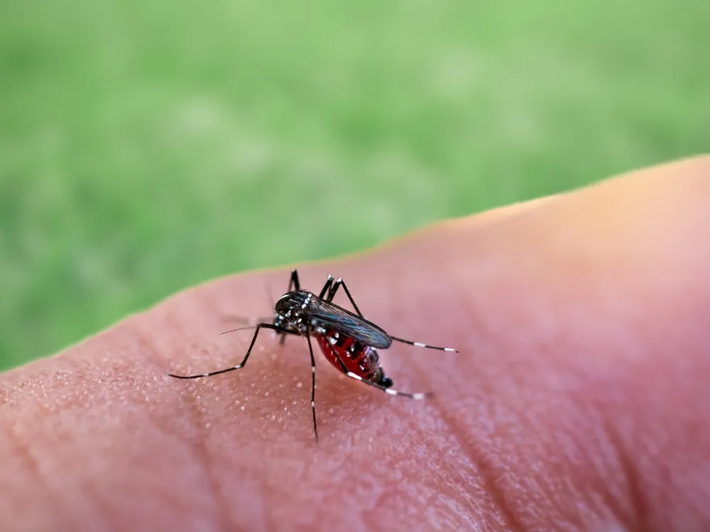 Da nổi đóm đỏ do muỗi đốt