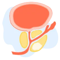 Sàng lọc tuyến tiền liệt