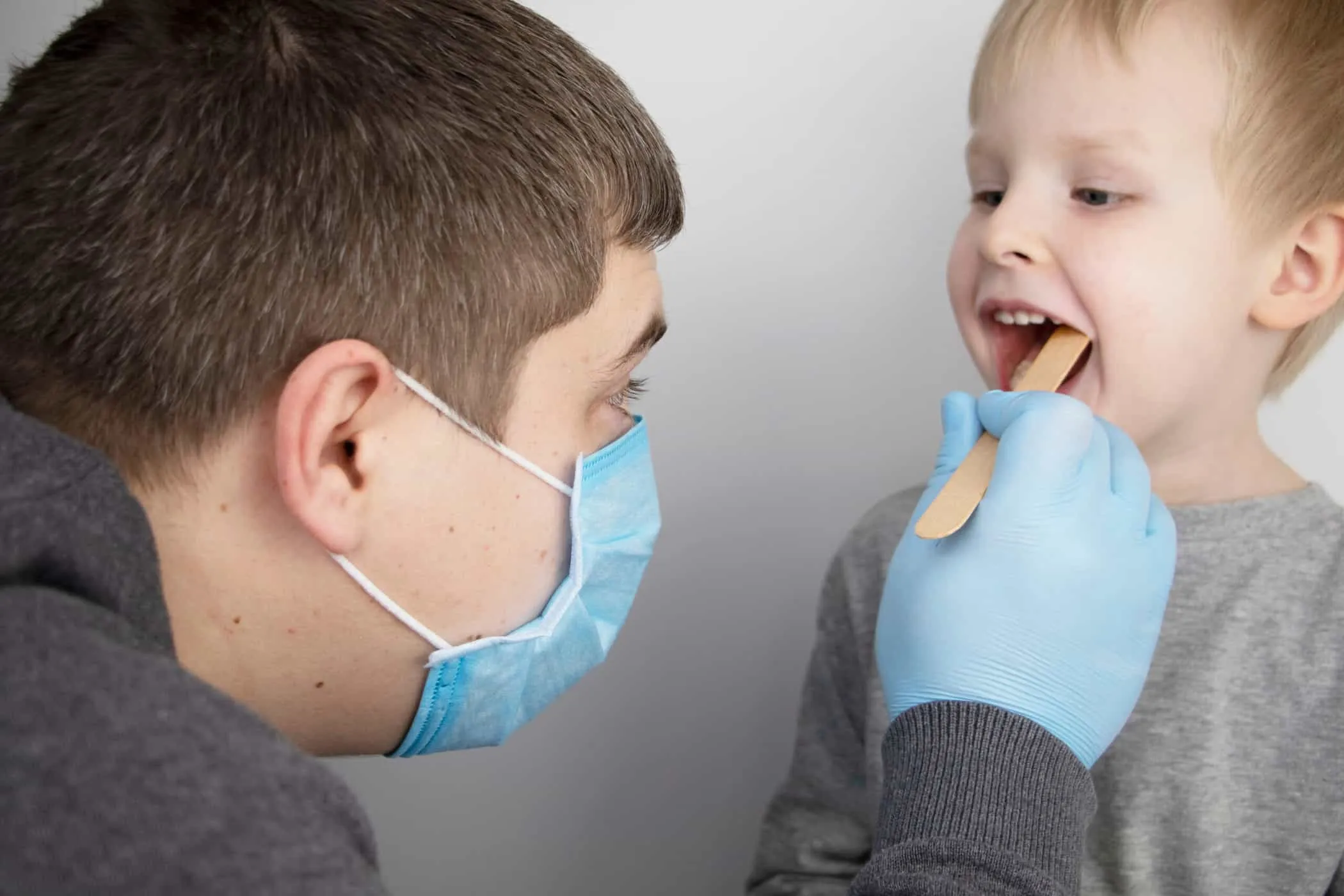 Chẩn đoán viêm amidan cấp