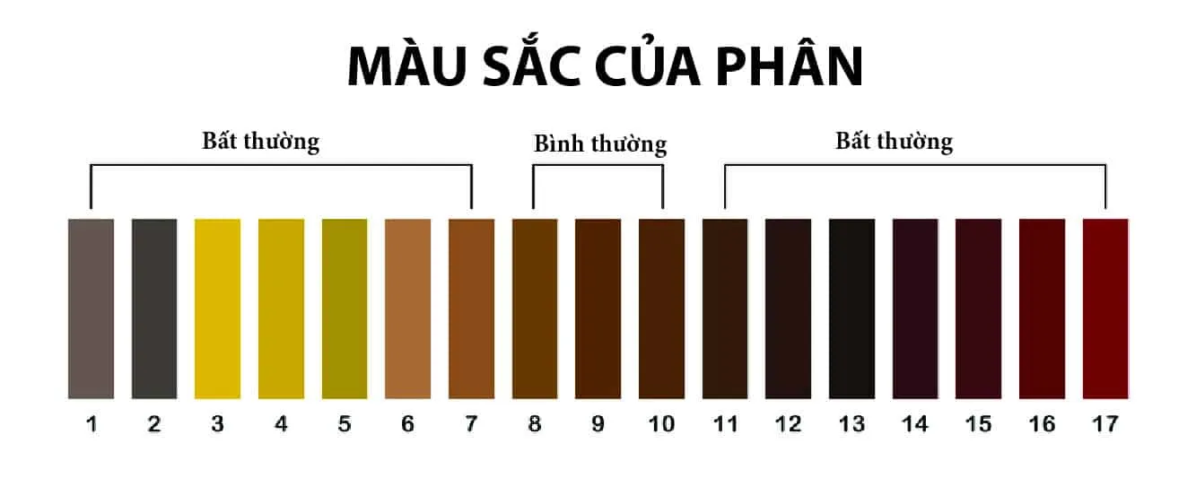 Nhìn phân đoán bệnh thông qua màu sắc của phân