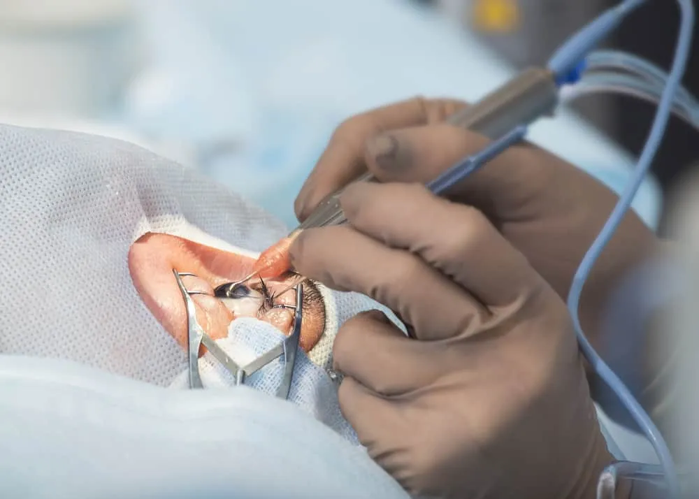 chăm sóc mắt sau mổ đục thủy tinh thể ngừa biến chứng