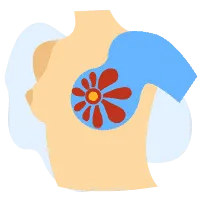 Sàng lọc ung thư vú