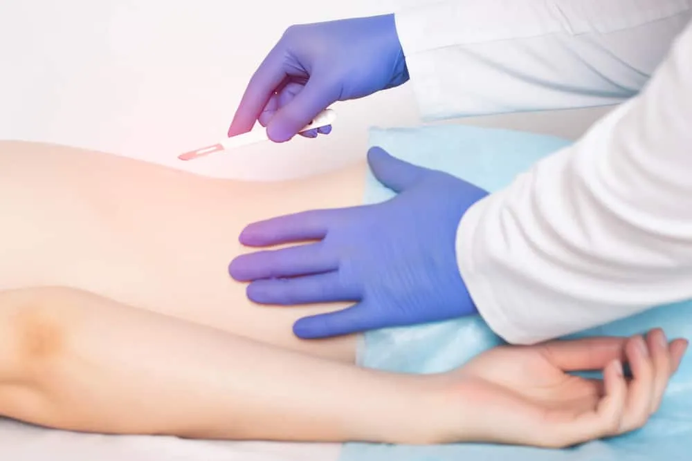 chăm sóc sau mổ bắt vít cột sống