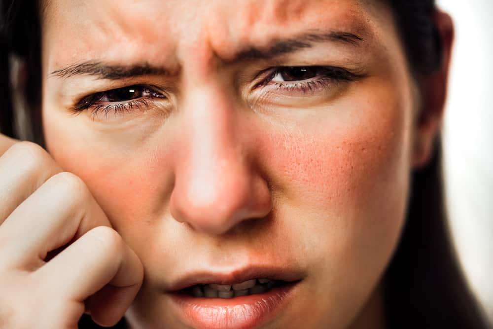 viêm da tiếp xúc