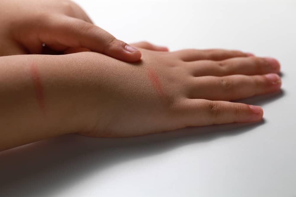 trẻ bị bạo hành thể chất